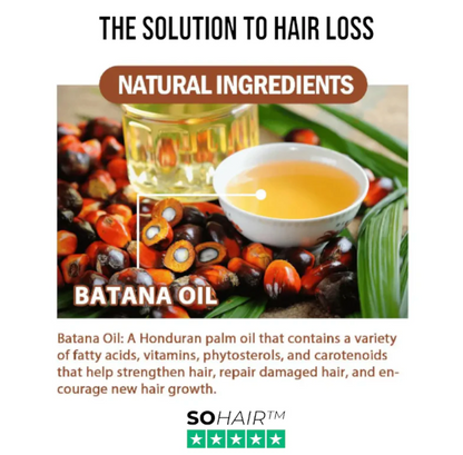 SOHair™ Batana Hair Oil | Special Offer!